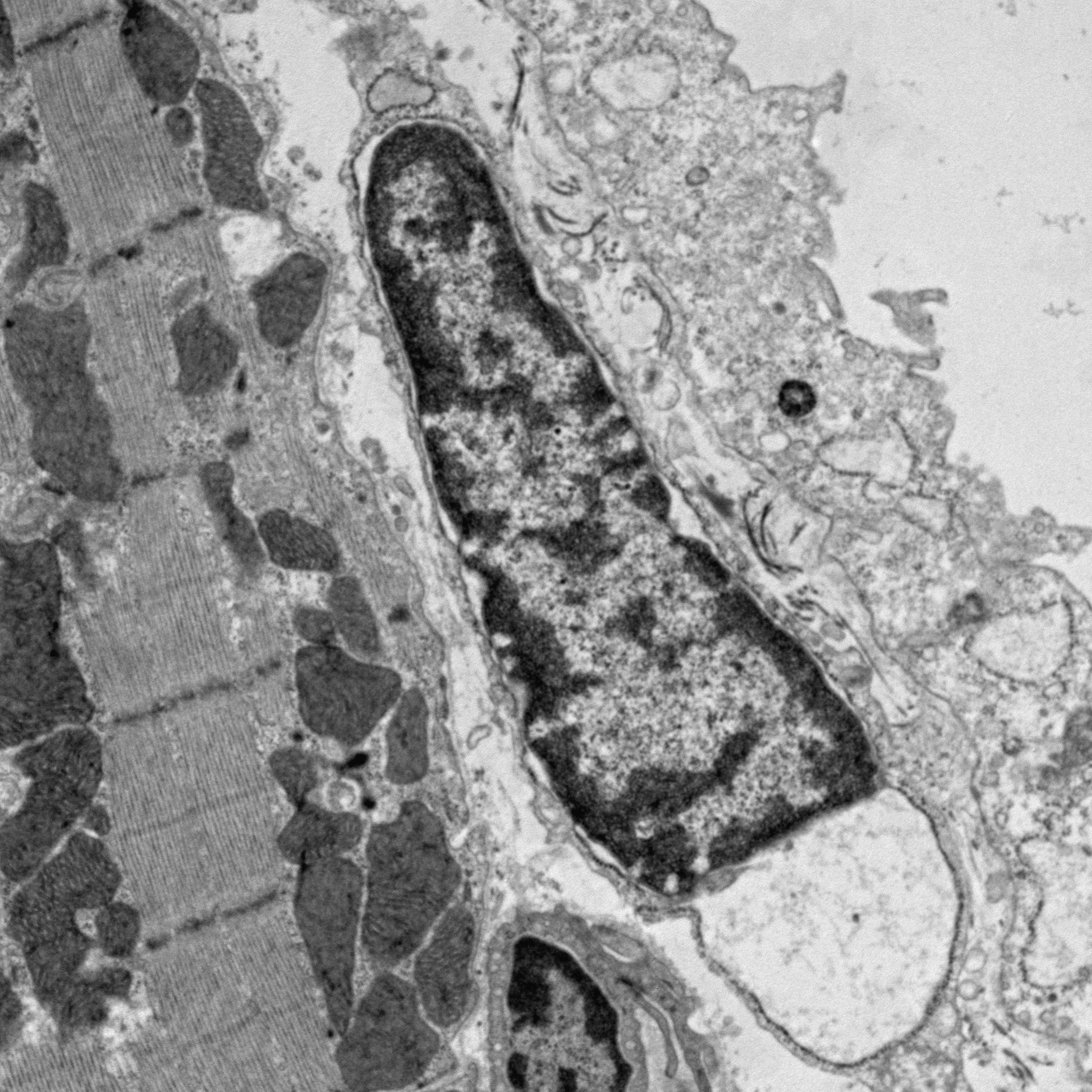 Autophagy autosis